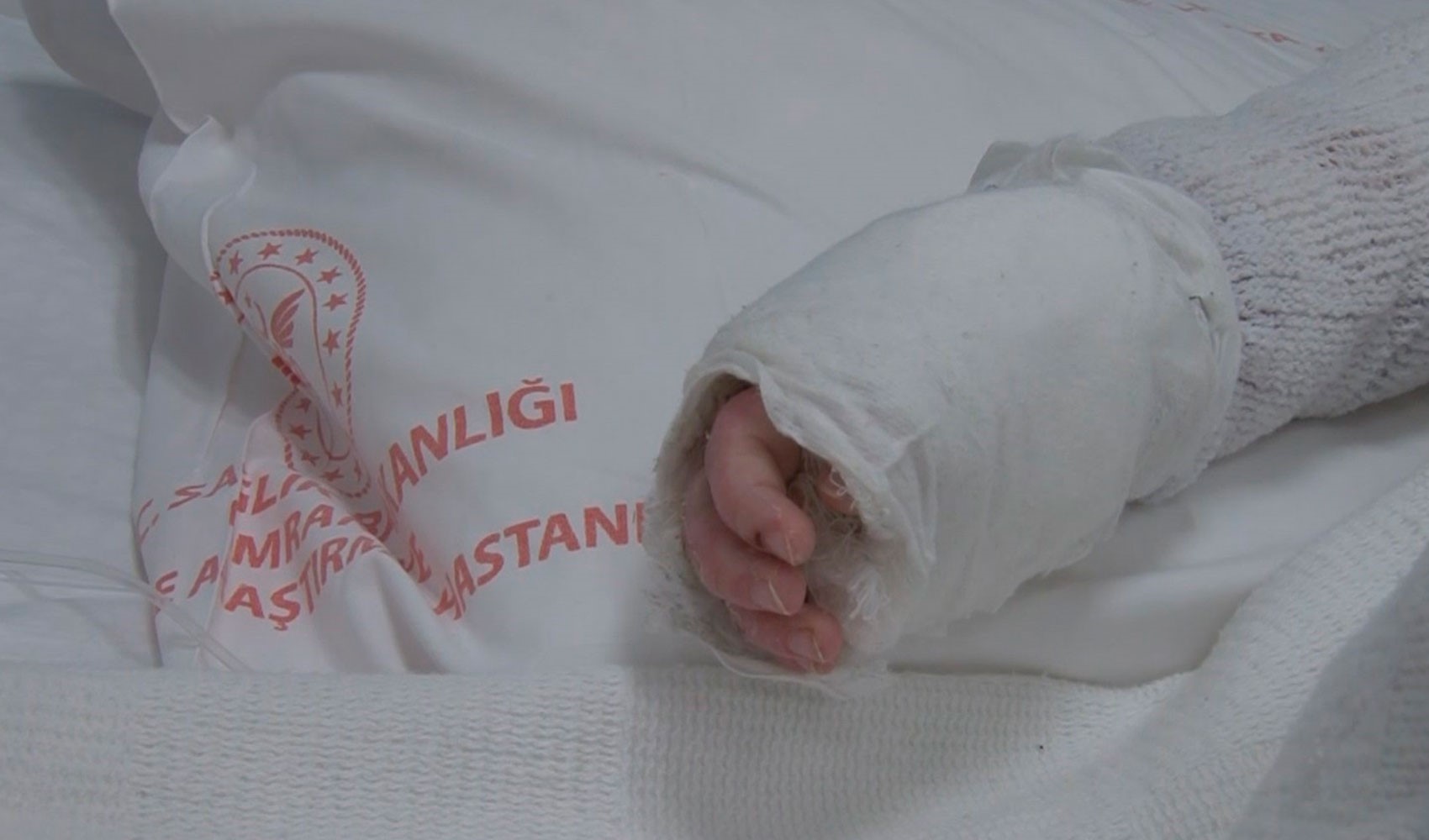 20 aylık bebeğin üzerine kaynar su döküldü!