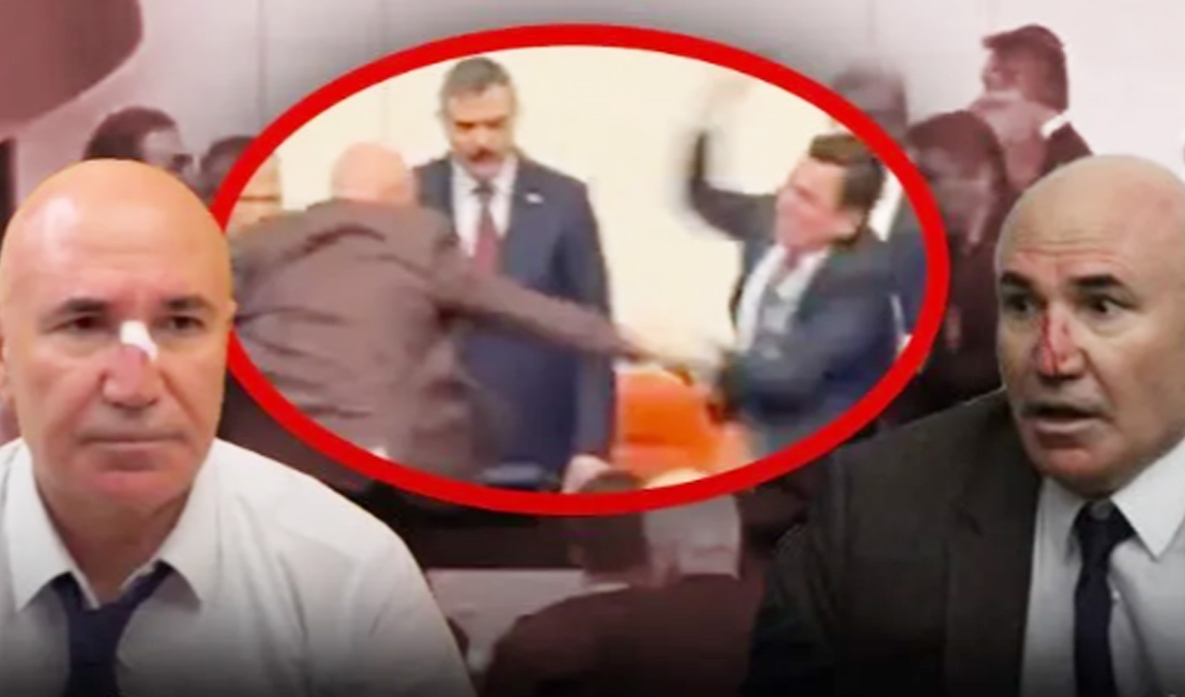 Meclis'te saldırıya uğrayan Mahmut Tanal hastaneye kaldırıldı: AKP'li Gökçek yumruk attı