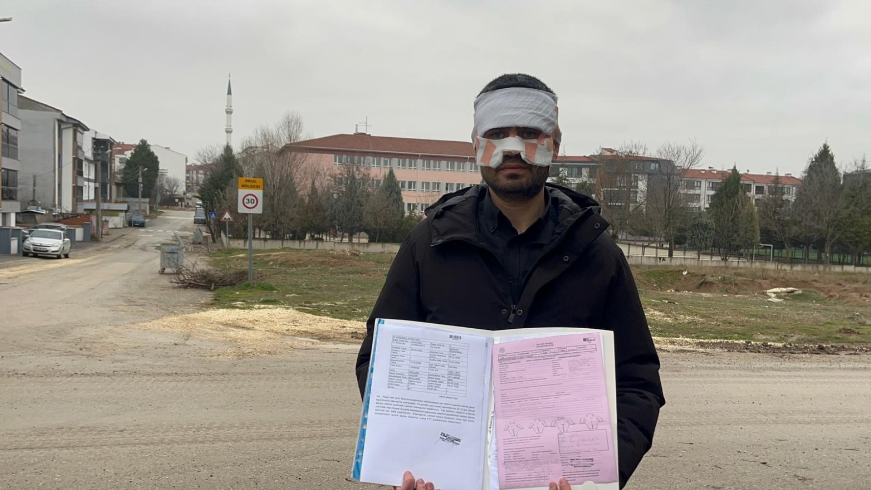 Rehber öğretmenin yüzüne sıcak çay fırlattığı fizik öğretmeni feci şekilde yandı