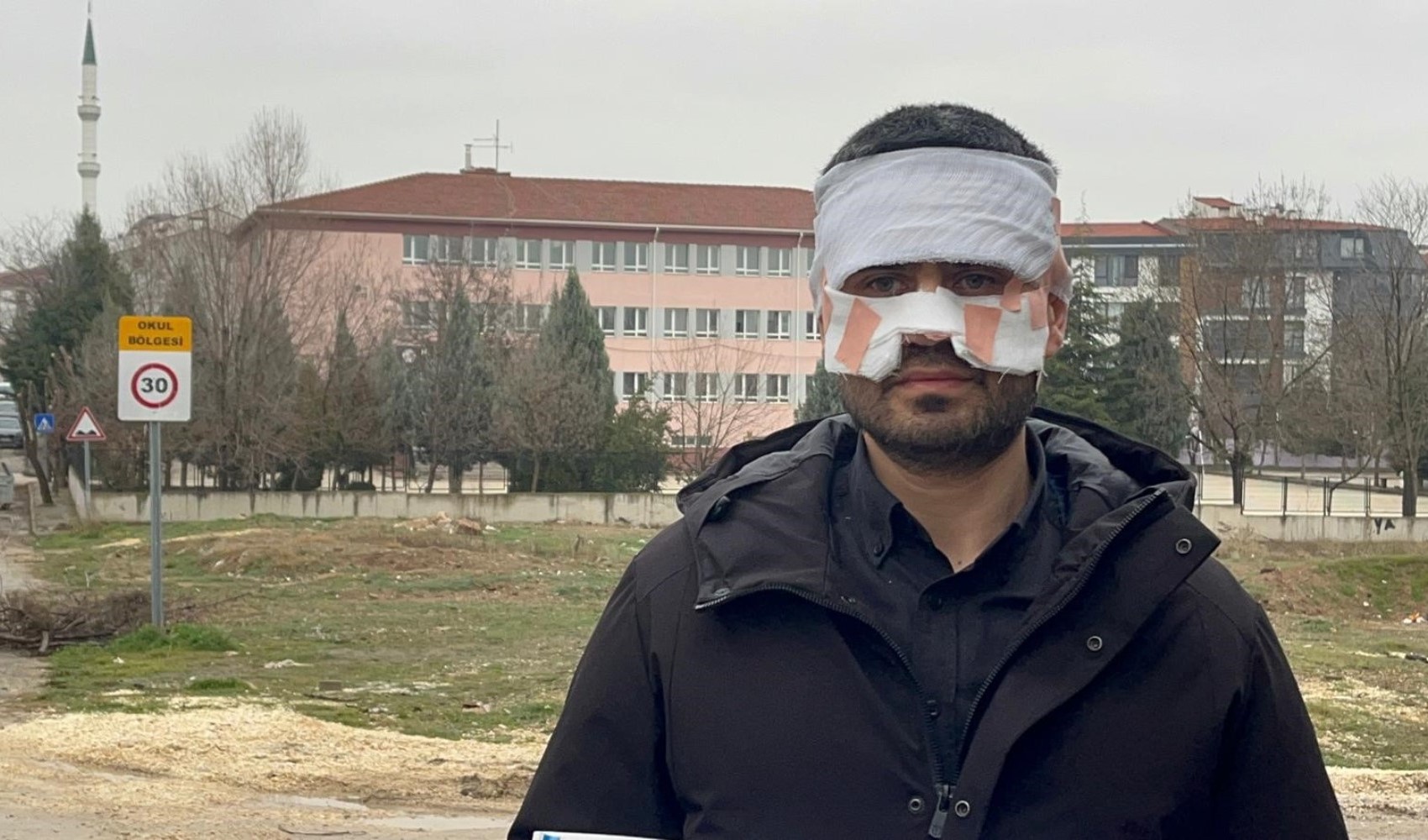 Rehber öğretmenin yüzüne sıcak çay fırlattığı fizik öğretmeni feci şekilde yandı