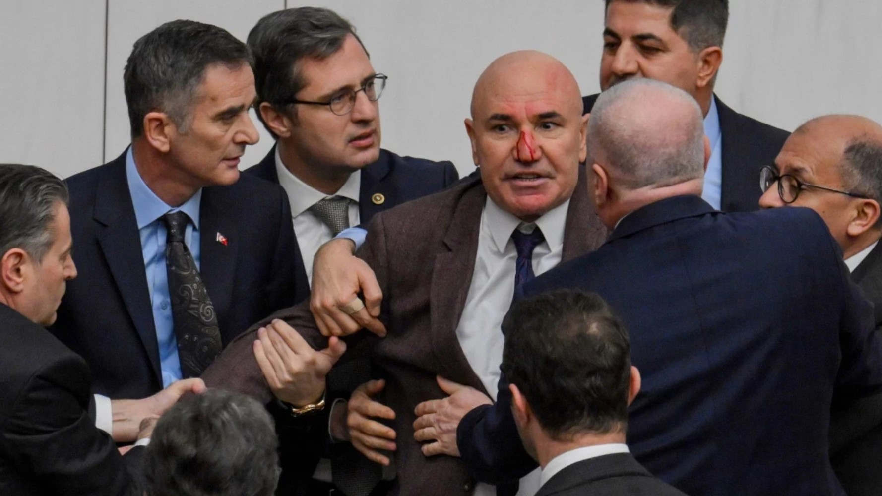 Yumruklu saldırı ile gündeme oturmuştu: Osman Gökçek'e destek mi verildi?