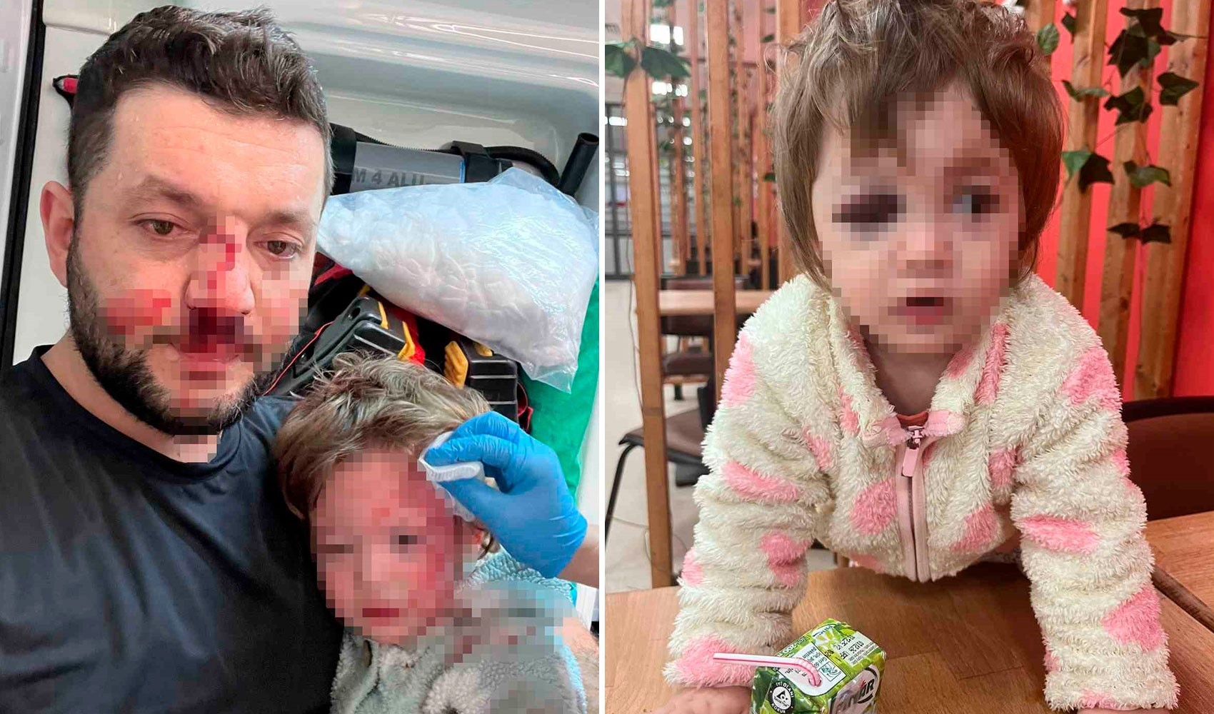 14 aylık bebeğiyle sopalı saldırıya uğrayan baba konuştu