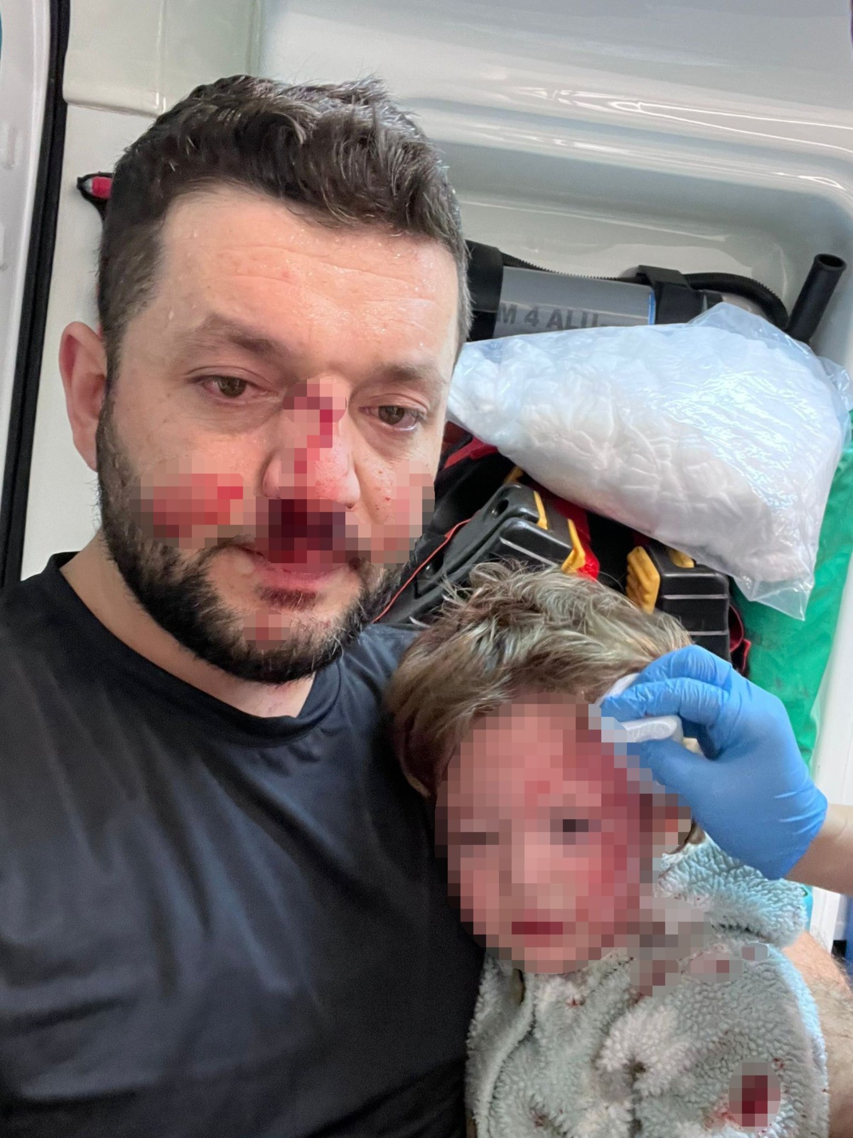 Yalova’da komşu kavgasında yaralanan bebek hakkında yeni gelişme: Üç gündür tedavi görüyordu