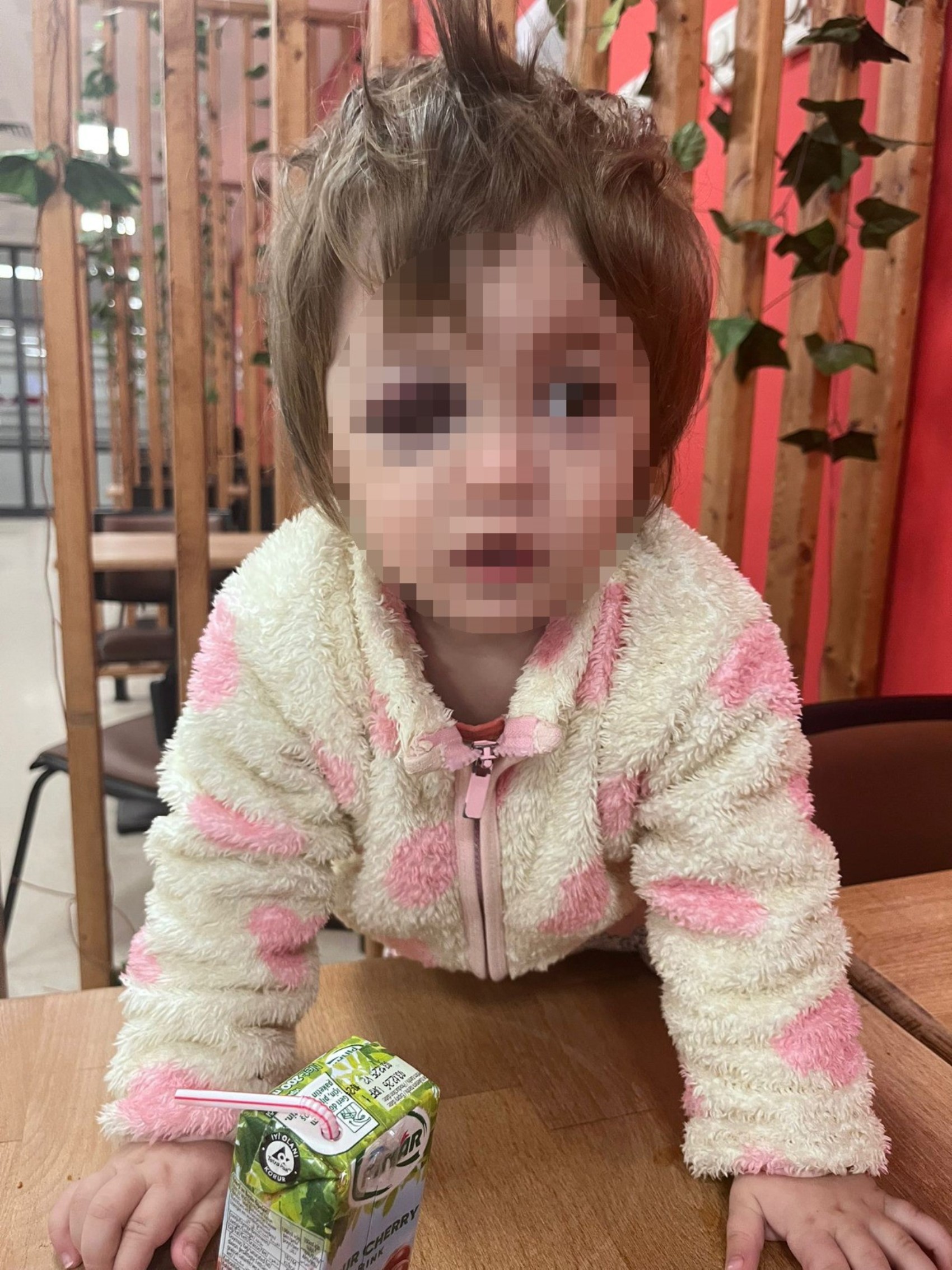 Yalova’da komşu kavgasında yaralanan bebek hakkında yeni gelişme: Üç gündür tedavi görüyordu