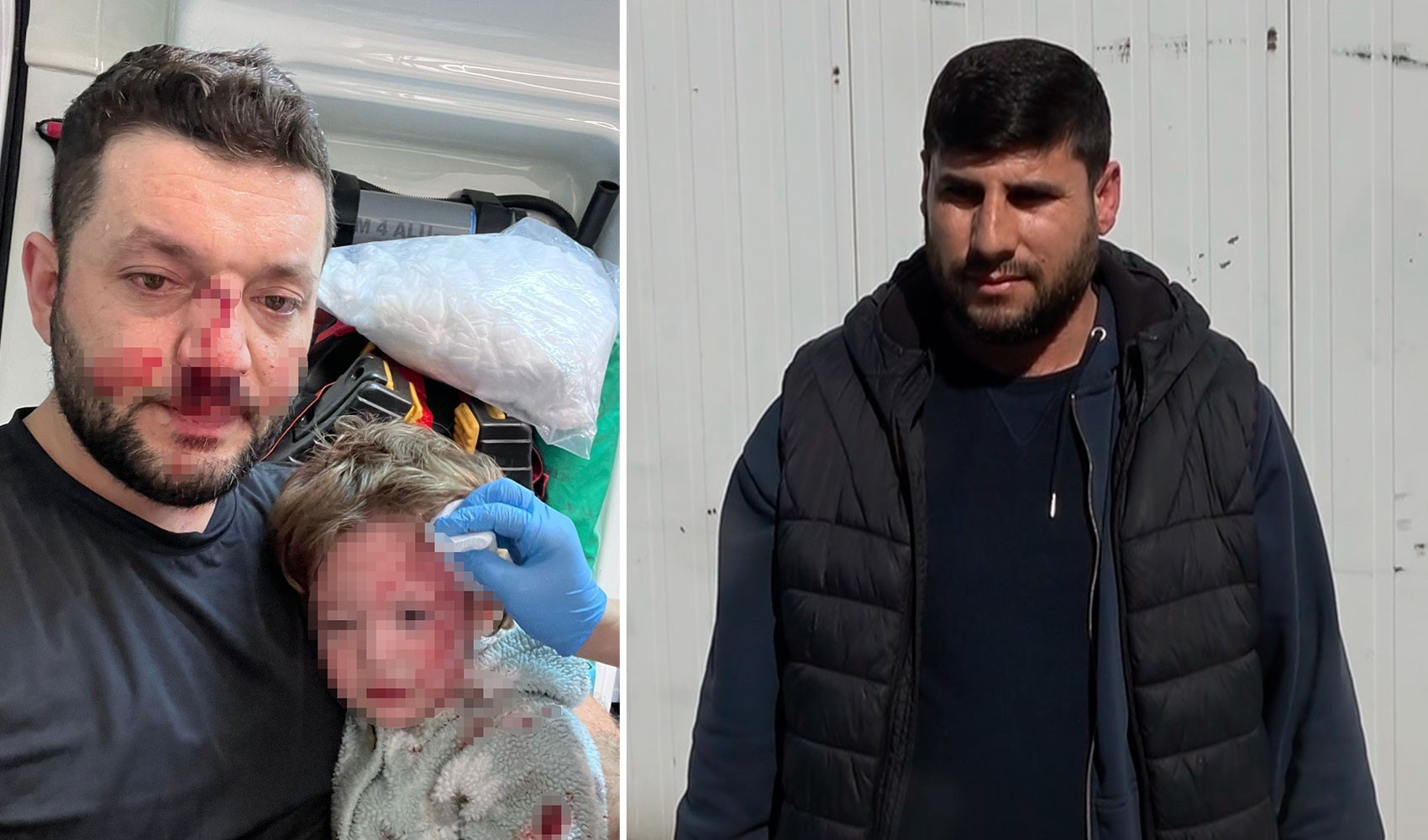 Yalova'daki komşu kavgasında karşı taraf konuştu