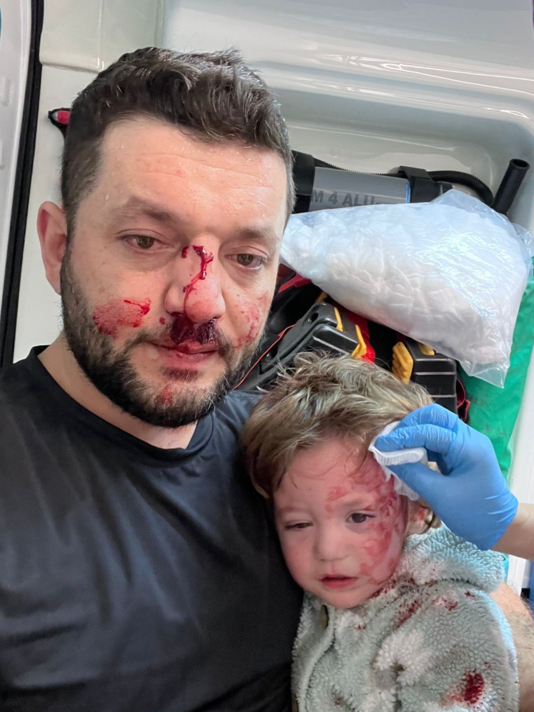 Yalova'da bebeğin yaralandığı komşu kavgasıyla ilgili baba ve anne ifade verdi: Kalıcı hasar tespit edildi