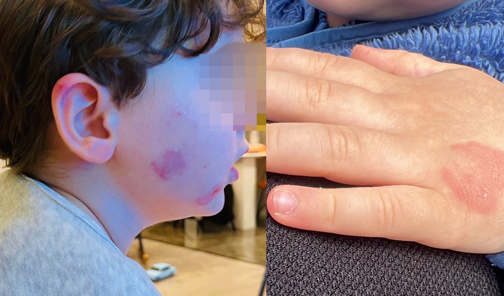 Kreşe bıraktığı çocuğunu darp edilmiş halde aldı