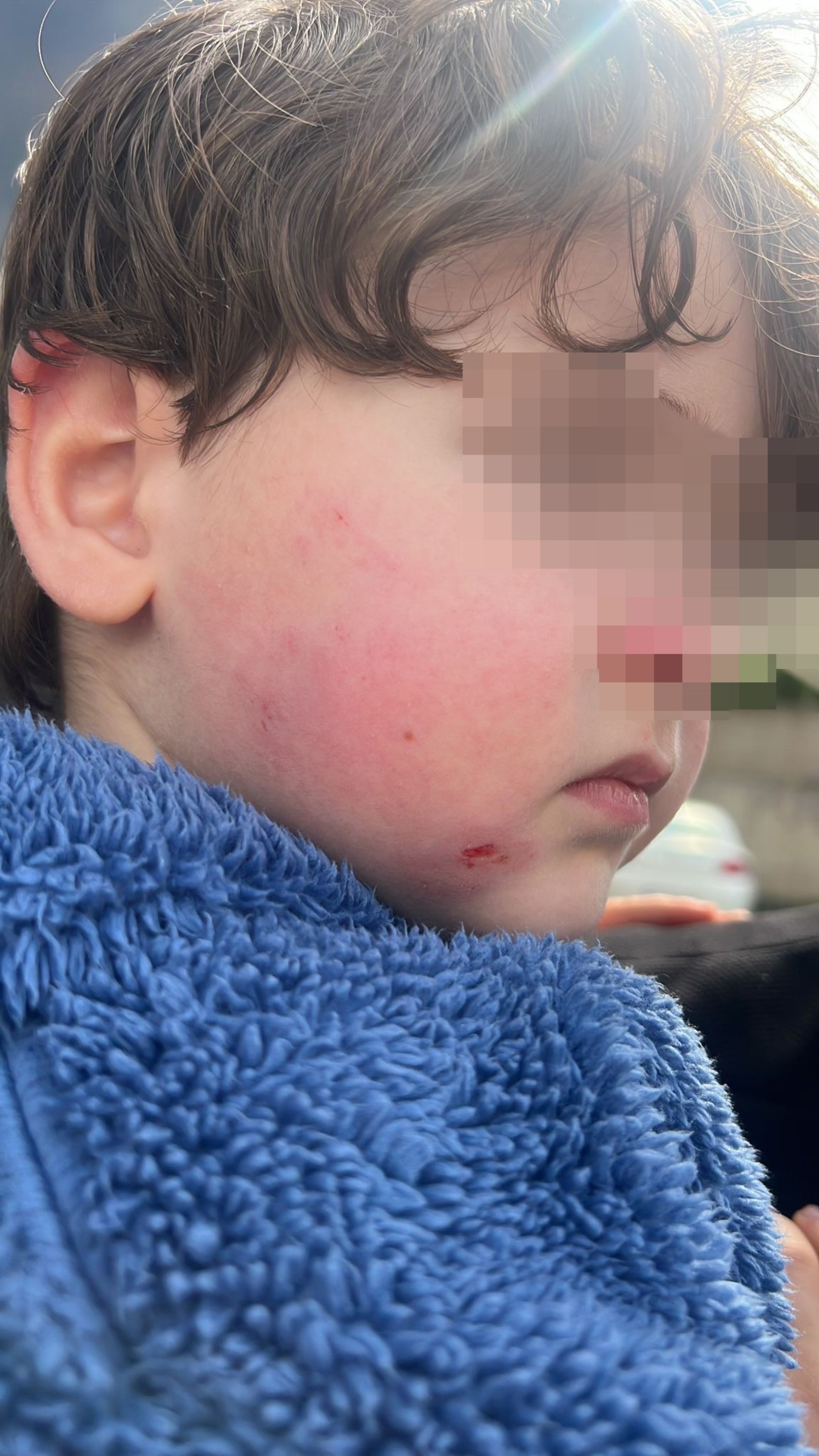 Kreşe bıraktığı çocuğunu darp edilmiş halde aldı: Kısa sürede gerçekleşti