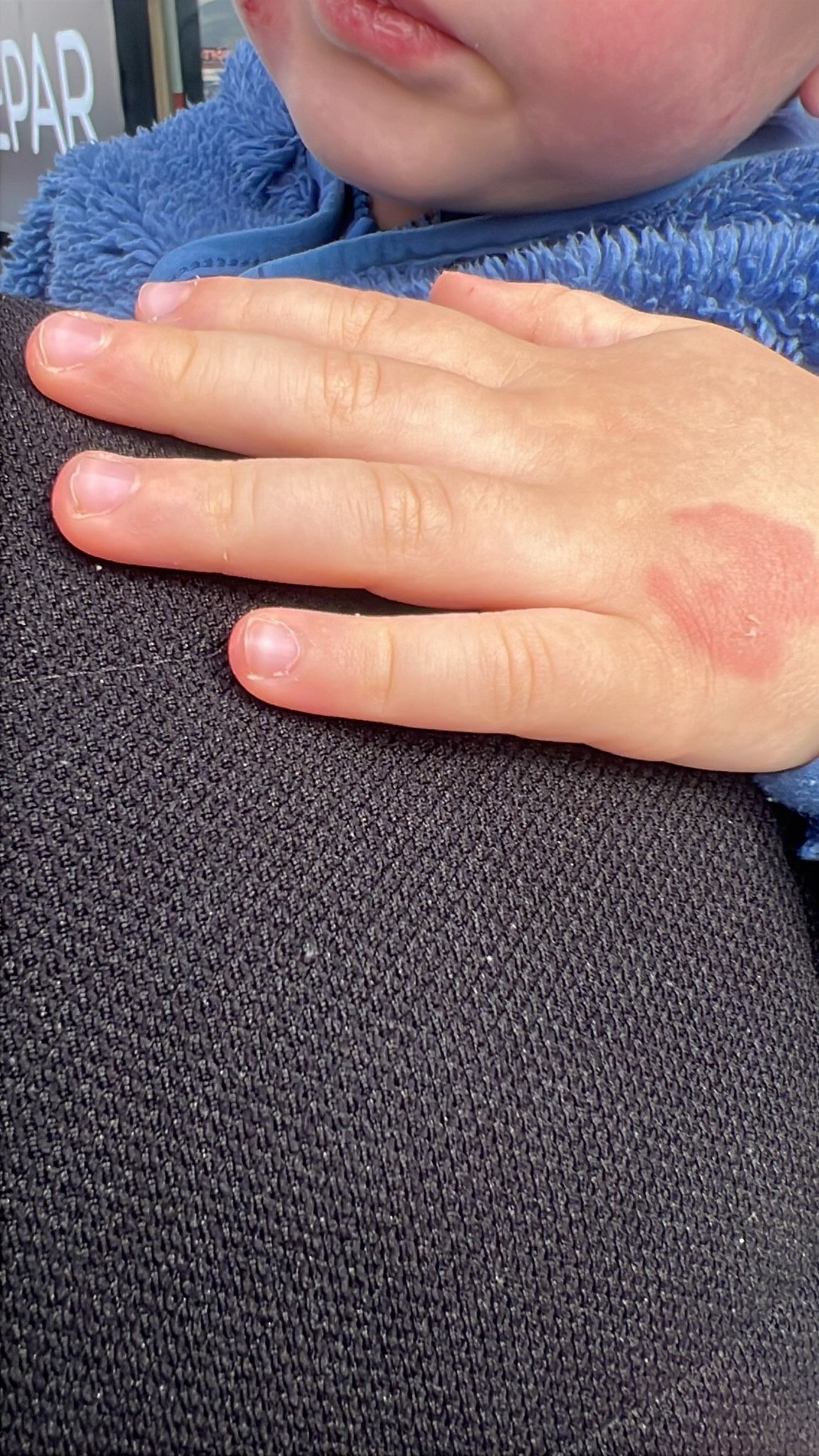 Kreşe bıraktığı çocuğunu darp edilmiş halde aldı: Kısa sürede gerçekleşti