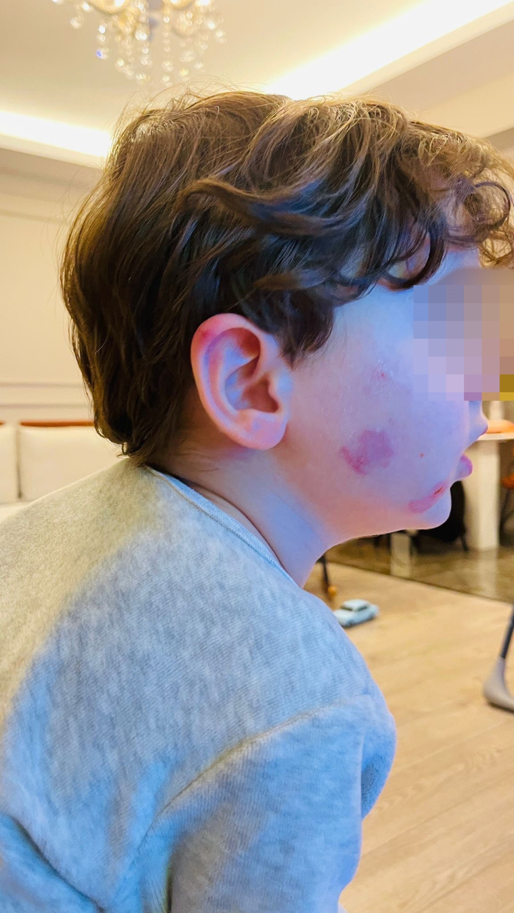 Kreşe bıraktığı çocuğunu darp edilmiş halde aldı: Kısa sürede gerçekleşti