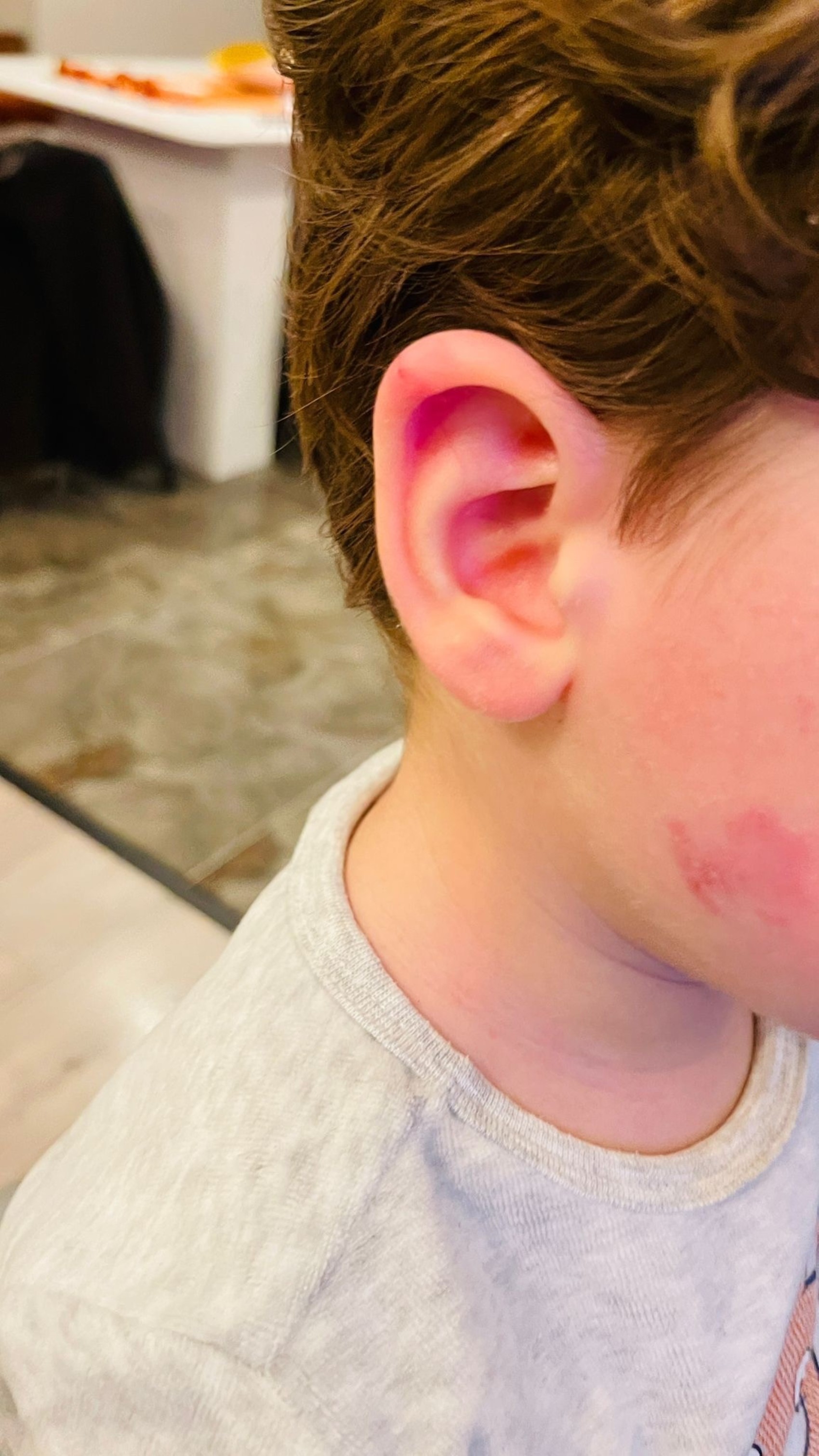 Kreşe bıraktığı çocuğunu darp edilmiş halde aldı: Kısa sürede gerçekleşti