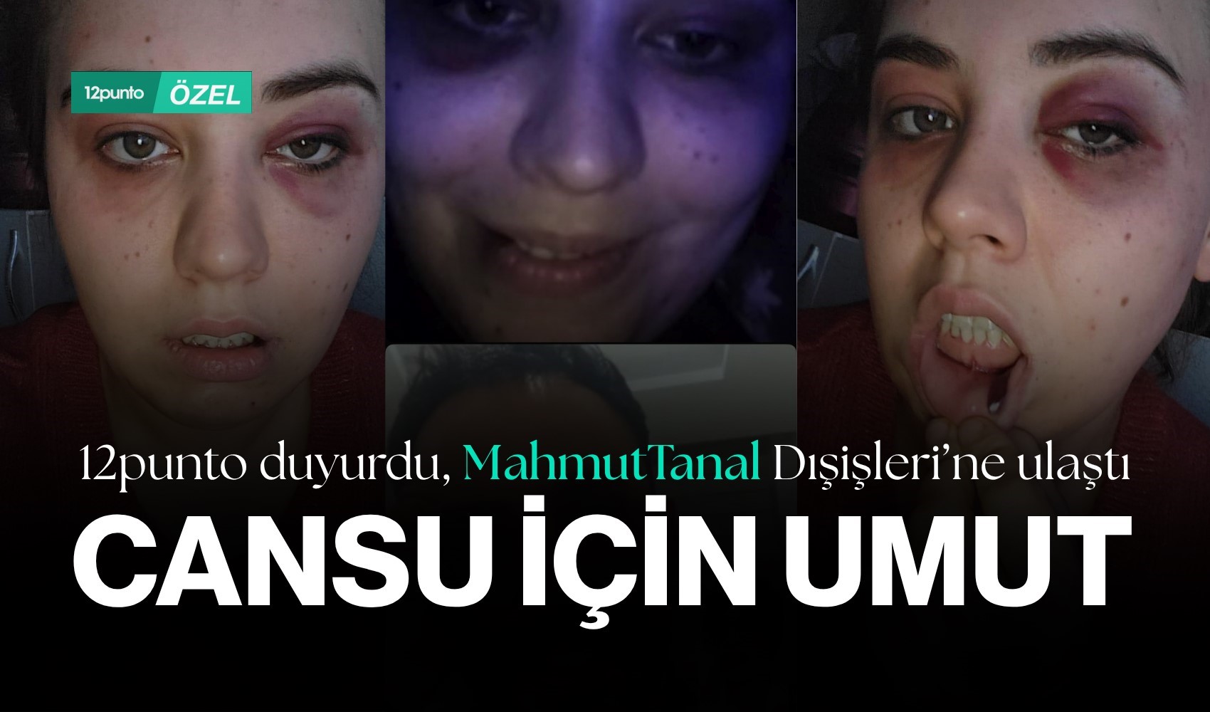 12punto duyurdu, Mahmut Tanal Dışişleri'ni aradı, yetkililer harekete geçti