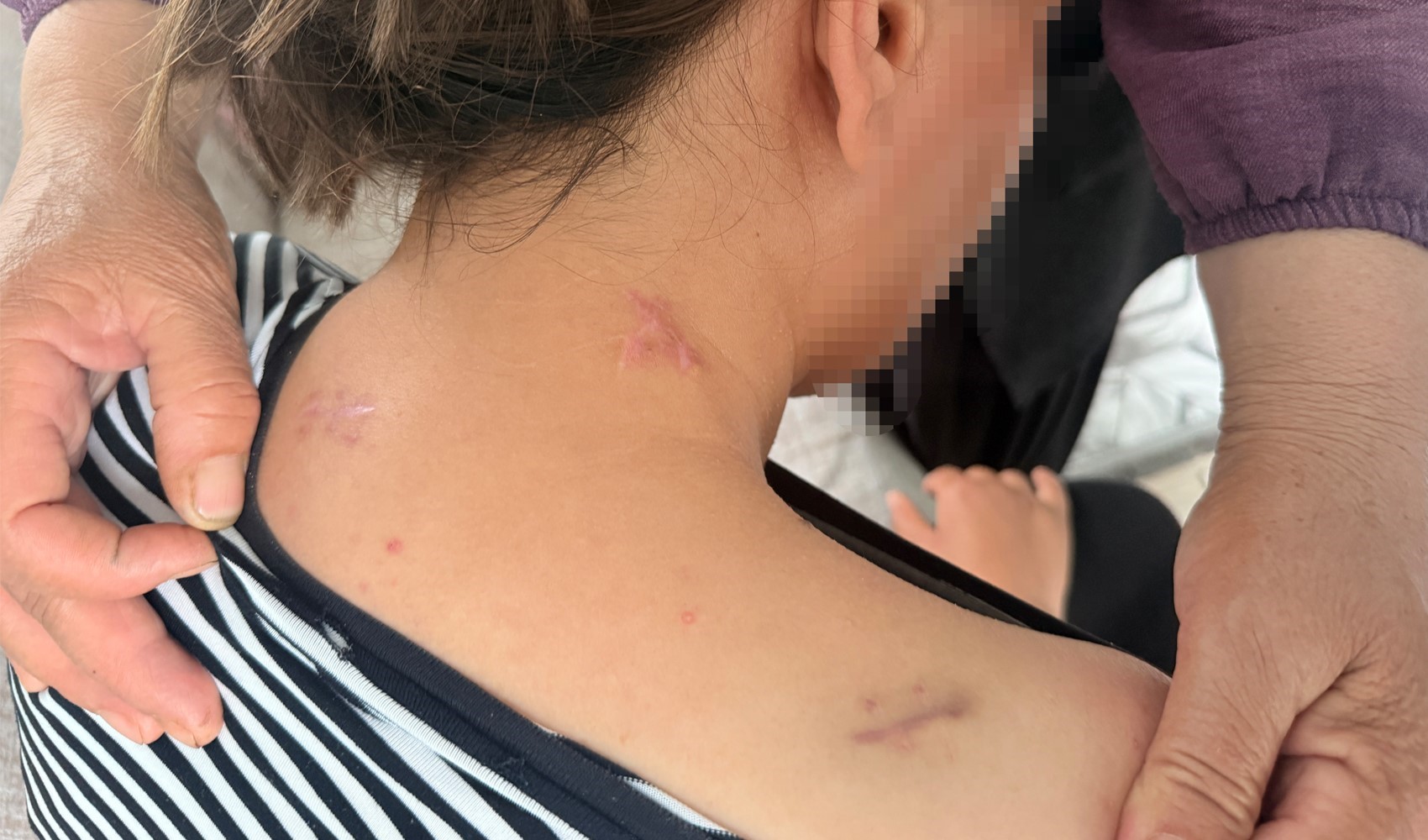 17 bıçak darbesi aldı, ölü numarasıyla kurtuldu