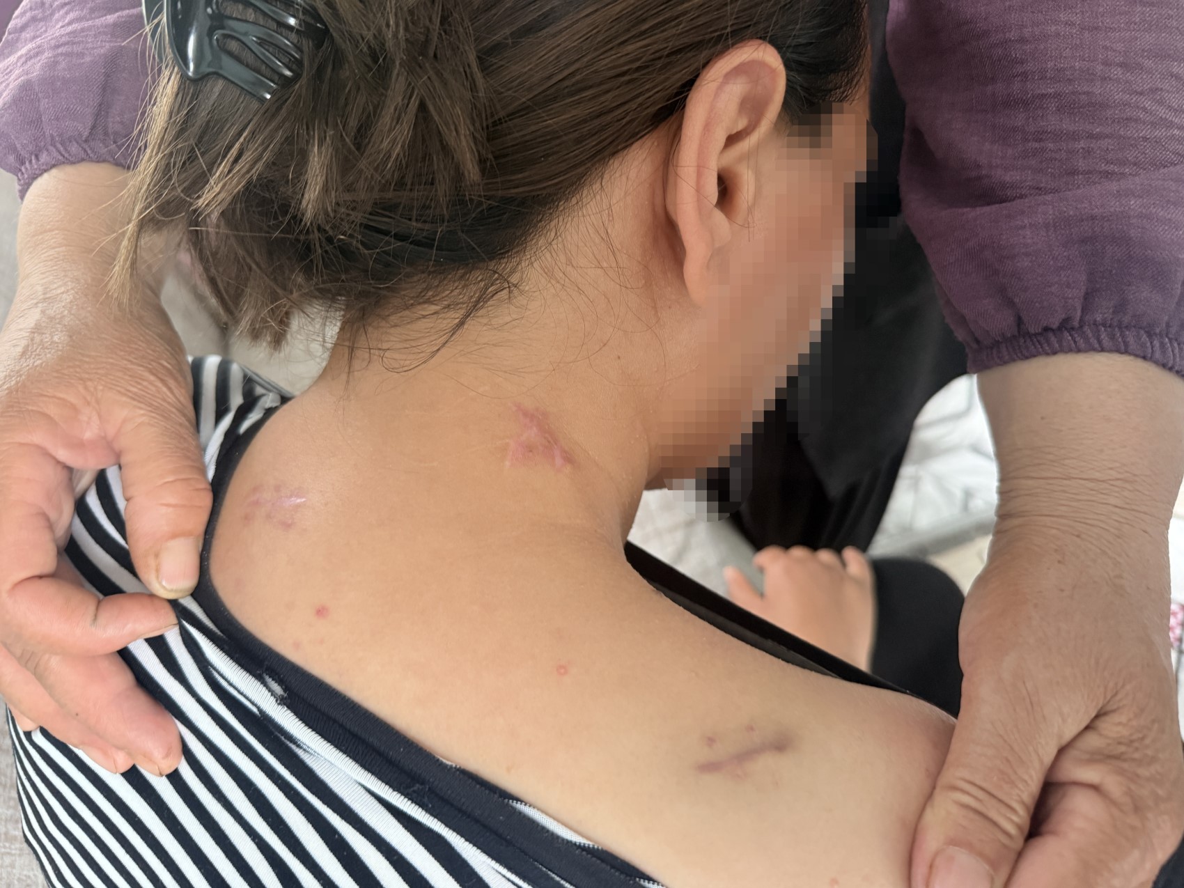 17 bıçak darbesi aldı, ölü numarasıyla kurtuldu