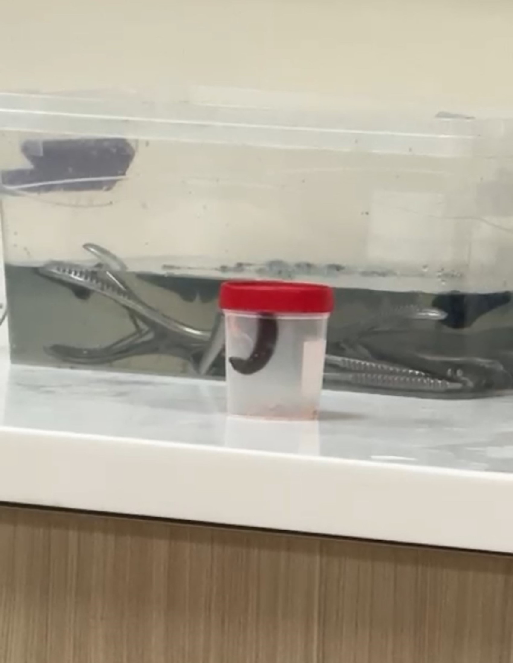 Altı yaşındaki çocuğun boğazından sülük çıktı