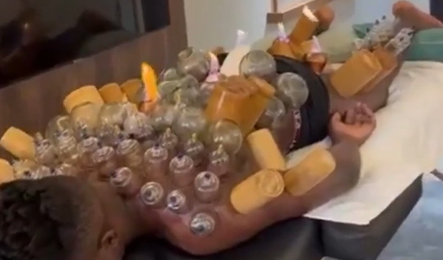 Andre Onana’nın hacamat paylaşımı gündem oldu