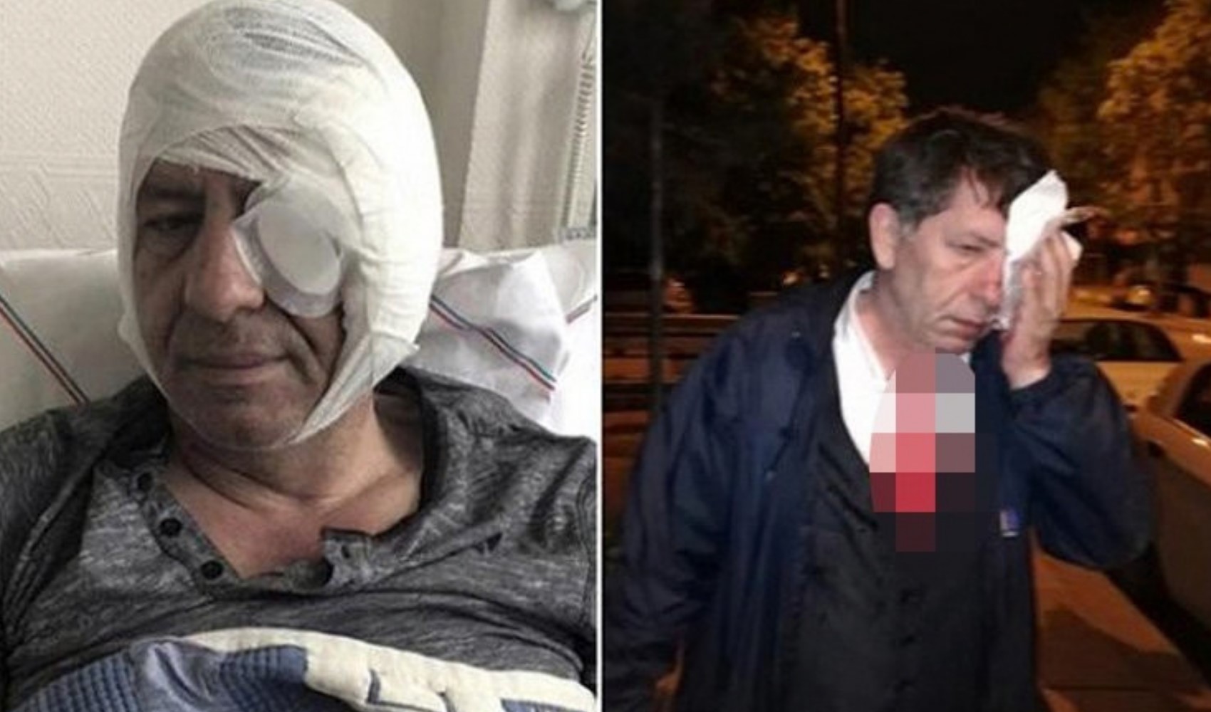 Gazeteciye saldırı davası: Savcı azmettirenin de bulunmasını istedi